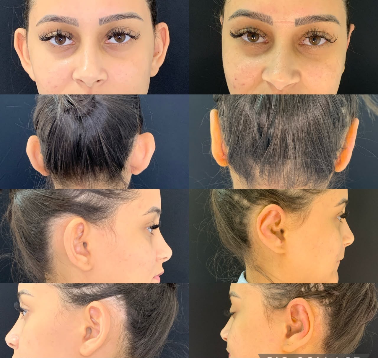 Resultado antes e depois — Estetic Face