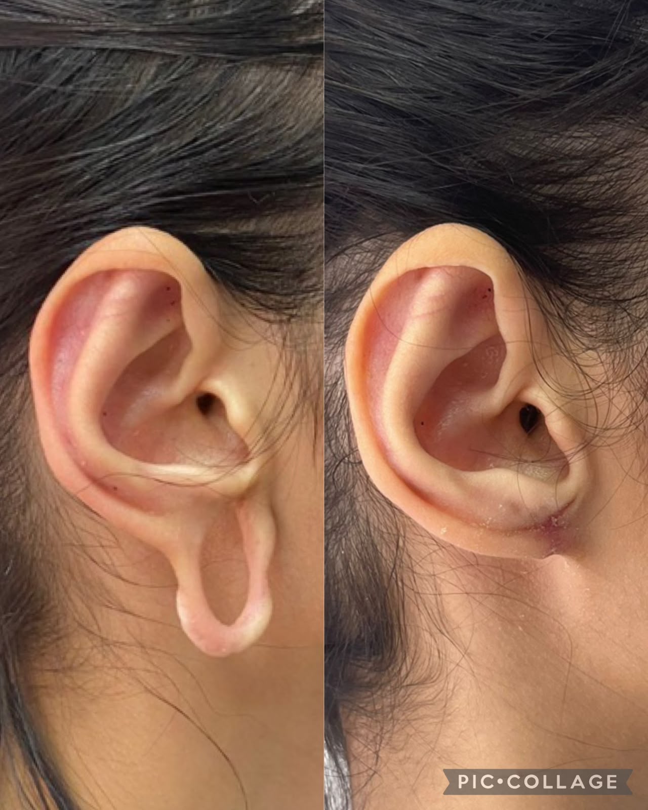 Resultado antes e depois — Estetic Face